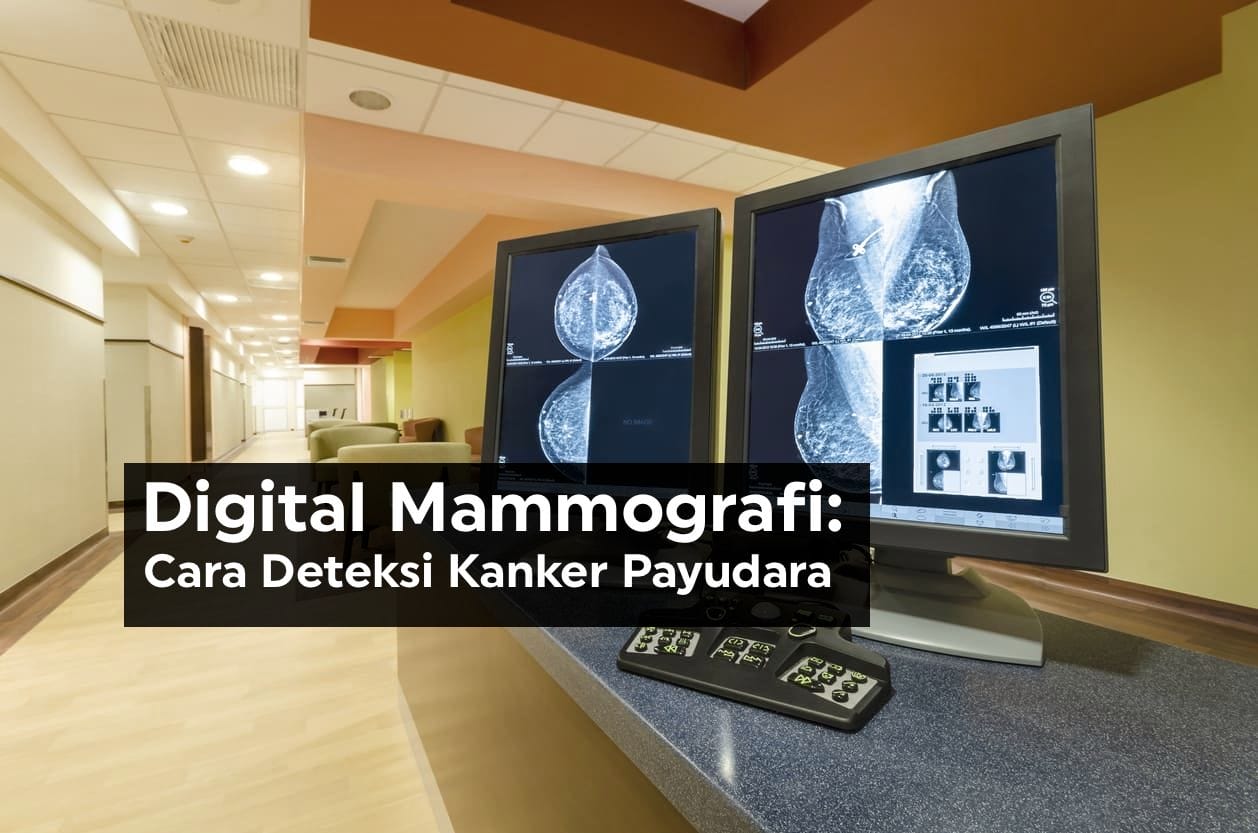 Digital Mammografi Cara Deteksi Kanker Payudara